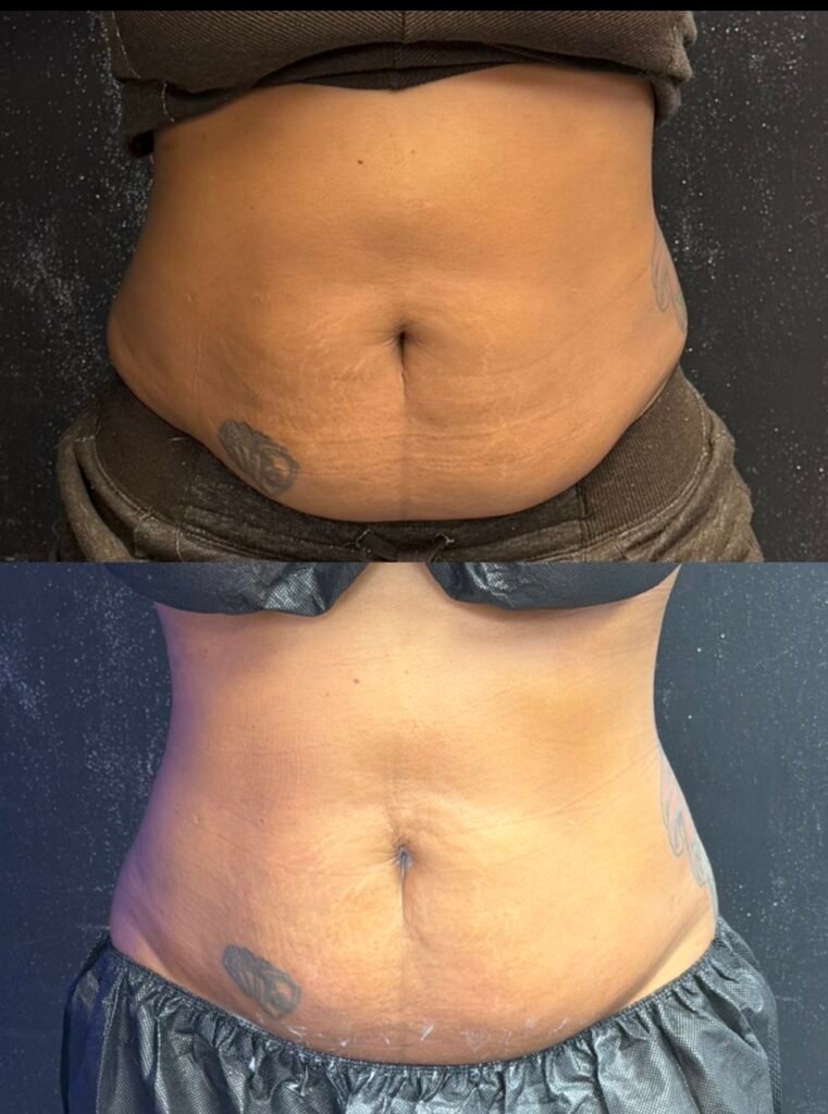 Body Sculpting business, sculpt your body