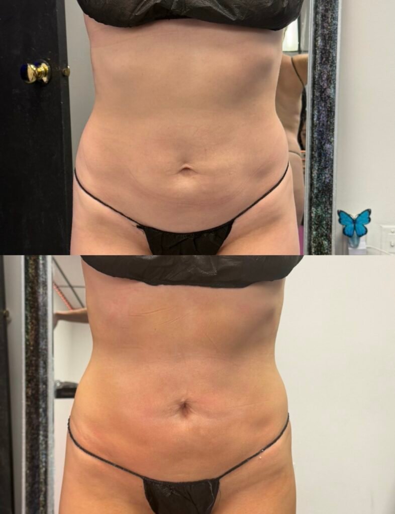 Body Sculpting business, sculpt your body