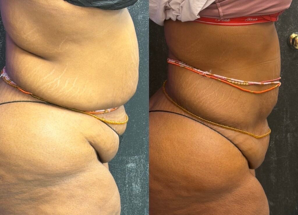 Body Sculpting business, sculpt your body