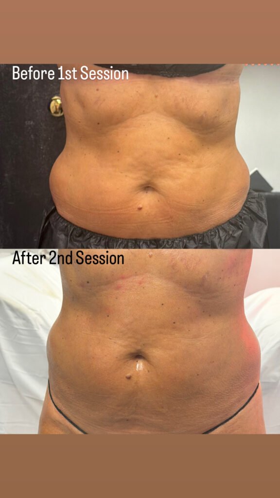 Body Sculpting business, sculpt your body