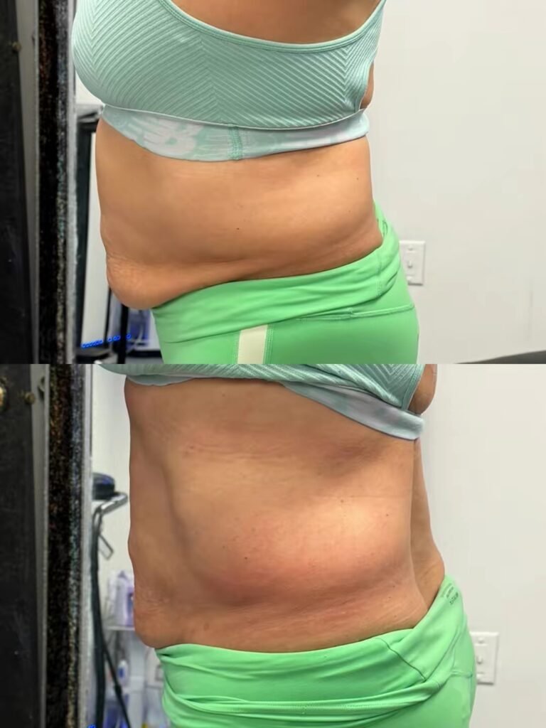Body Sculpting business, sculpt your body