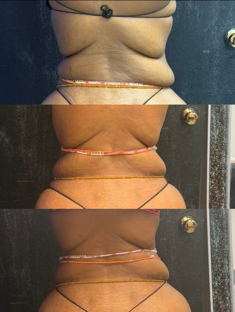 Body Sculpting business, sculpt your body