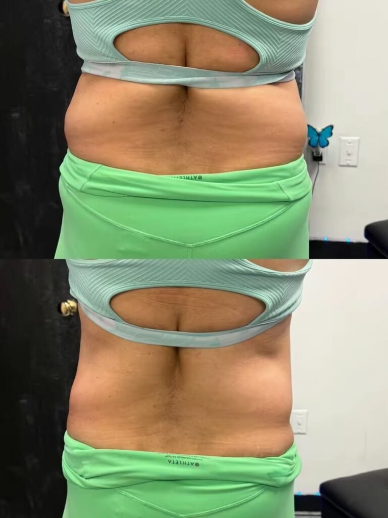 Body Sculpting business, sculpt your body