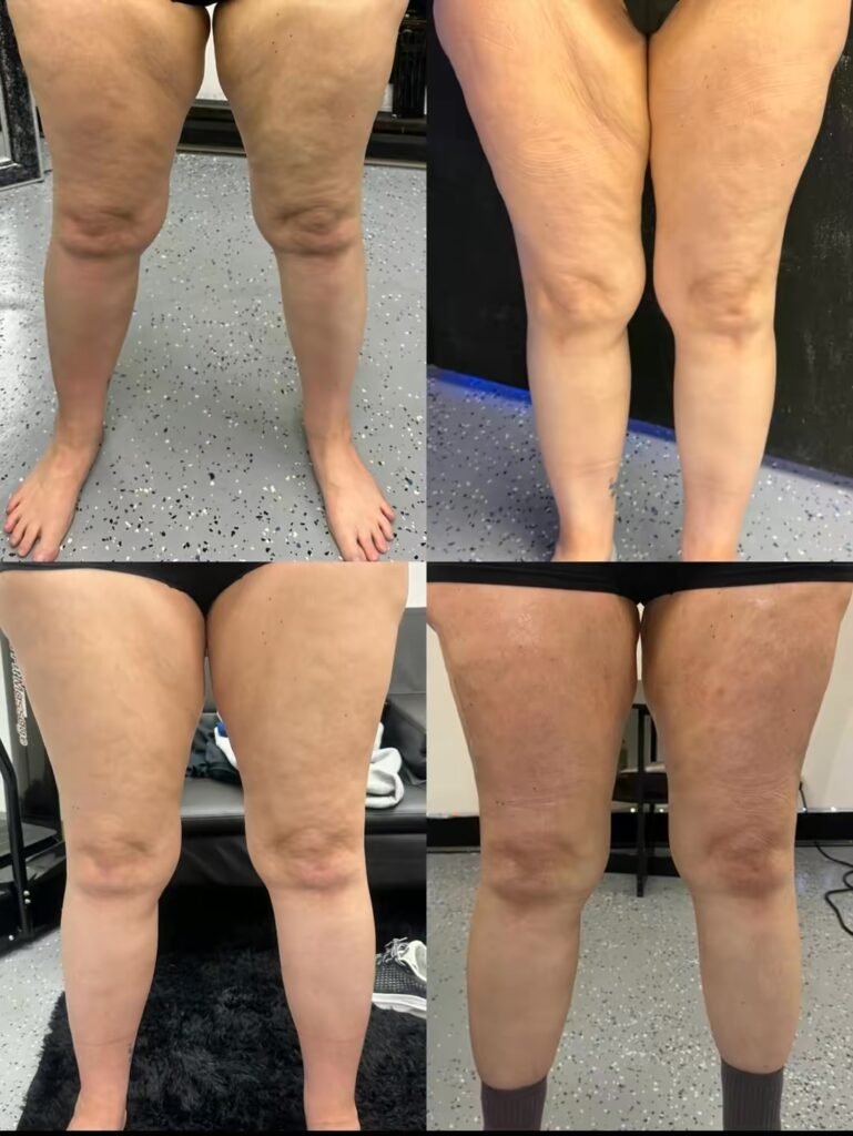 Body Sculpting business, sculpt your body