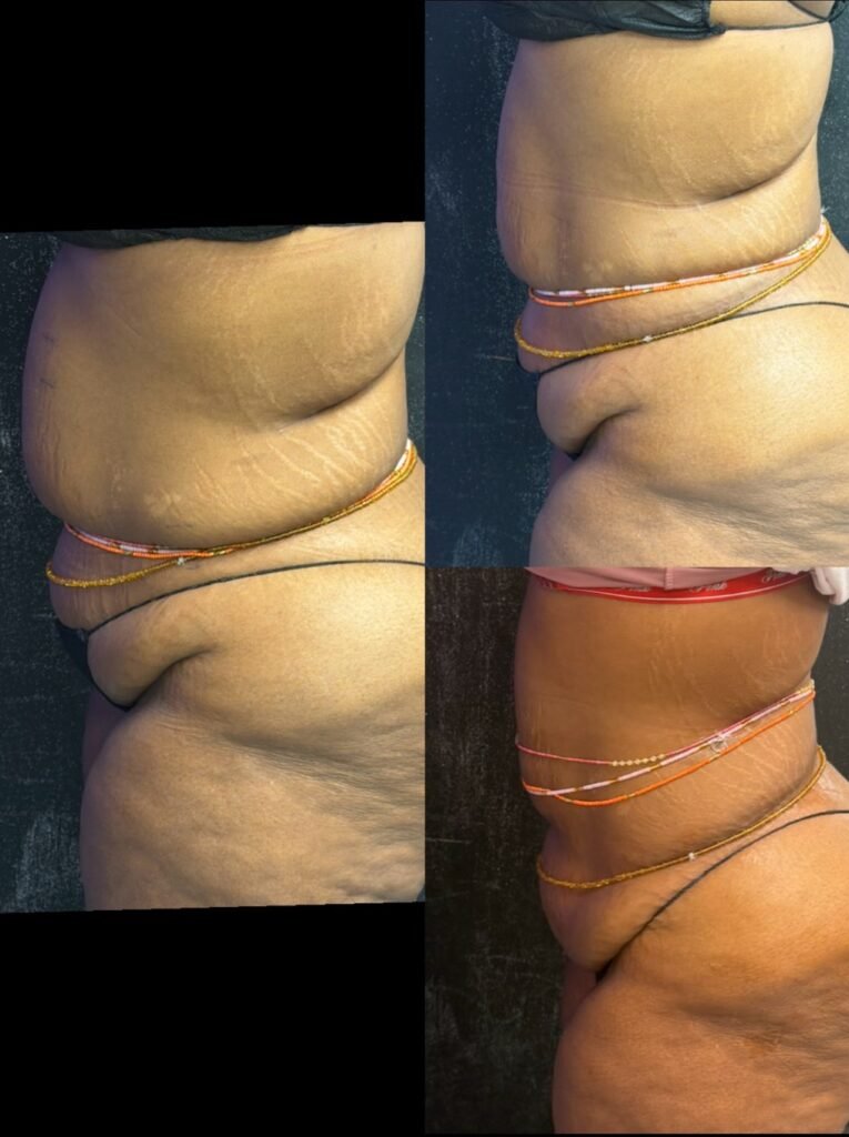 Body Sculpting business, sculpt your body