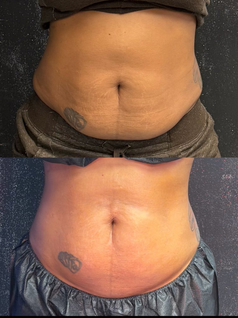 Body Sculpting business, sculpt your body